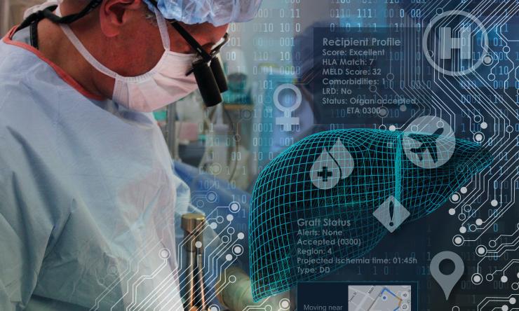 TMC Liver transplant A.I. - illustration by Scott Holmes, CMI