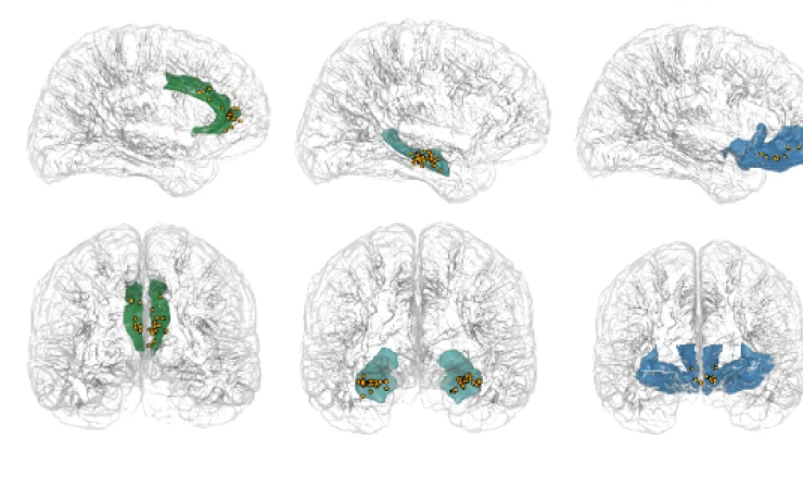 Drawings of brain sections showing colored areas to indicate brain activity