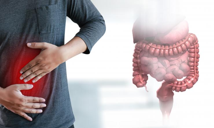 Inflammatory Bowel Disease