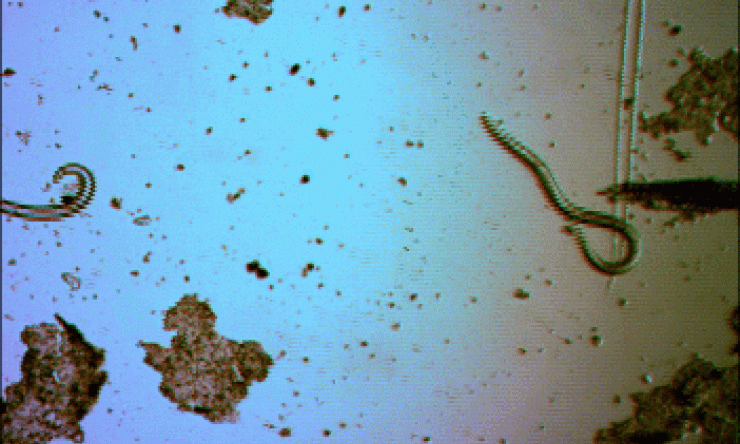 Hookworm larvae