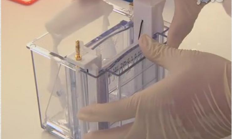 Detection of Functional Matrix Metalloproteinases by Zymography