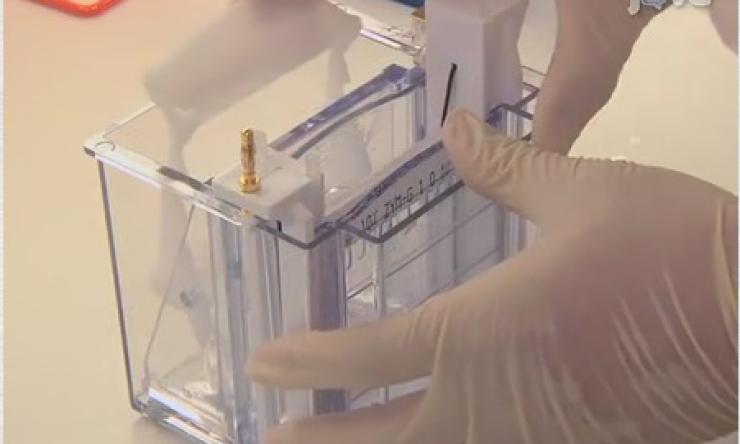 Detection of Functional Matrix Metalloproteinases by Zymography