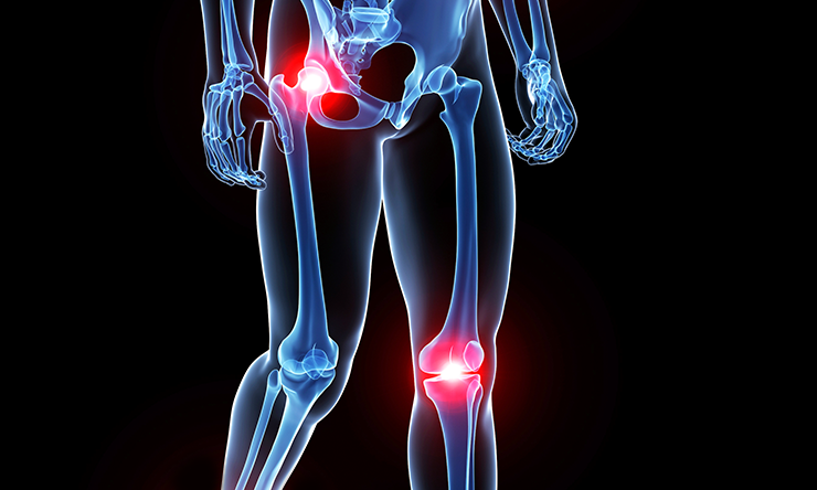 Patent Issued For Osteoarthritis Gene Therapy Product Patent Issued For Osteoarthritis Gene Therapy Product