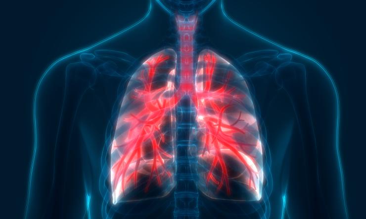 Clinical Trial Uses Immunotherapy To Treat Mesothelioma