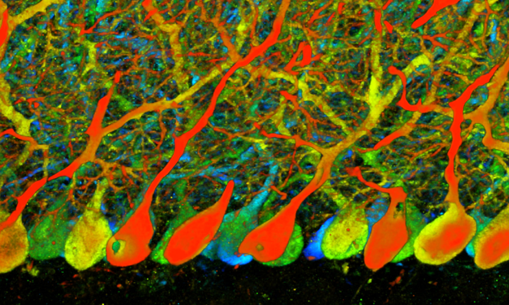 neurosurgery landing research