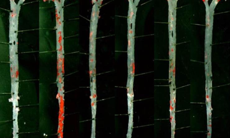 Atherosclerotic lesions in aortae from Ldlr KO mice fed a Western style diet.