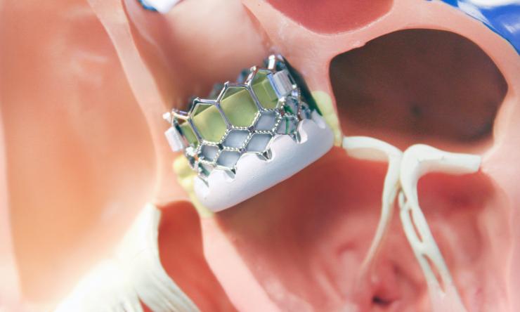 Percutaneous heart valve